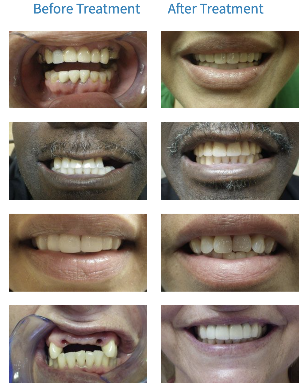 SMILE GALLERY Dr. Justin Nylander. Allen Dentistry. General, Cosmetic, Restorative, Preventative Dentistry. Dentist in Allen, TX 75013